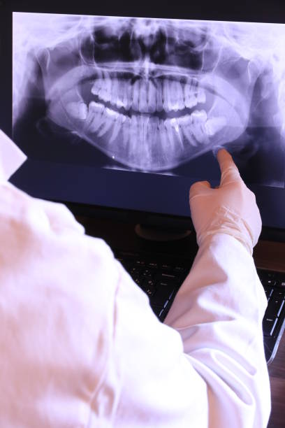 Best Emergency Root Canal Therapy in Arapahoe, WY