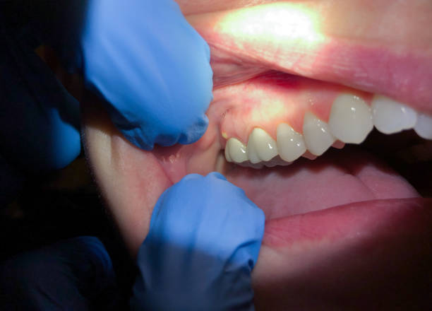 Best Walk-In Emergency Dental Services in Arapahoe, WY